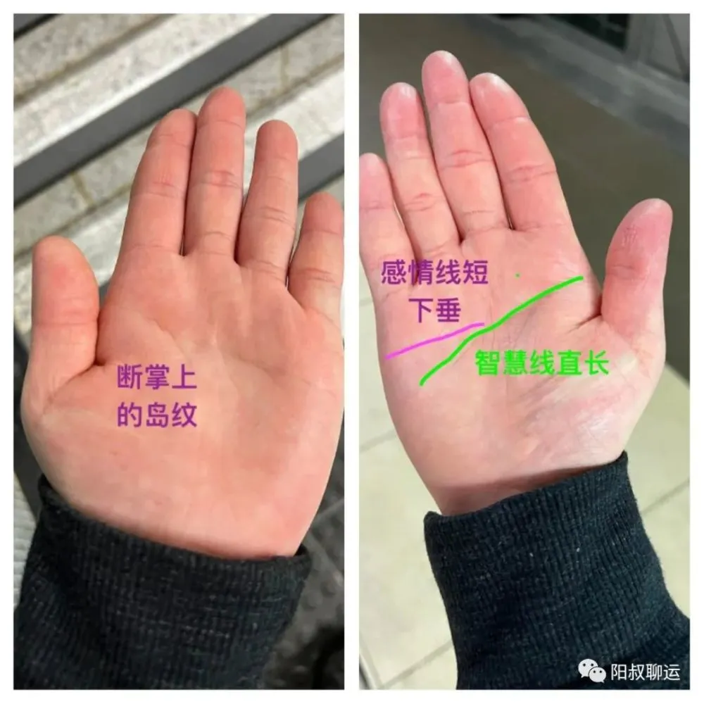 手相断掌女_断掌手相图解女_女断掌右手相算命图解