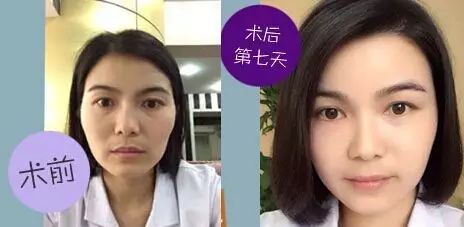 反衬高颧骨的女星面相，原来是这样的！