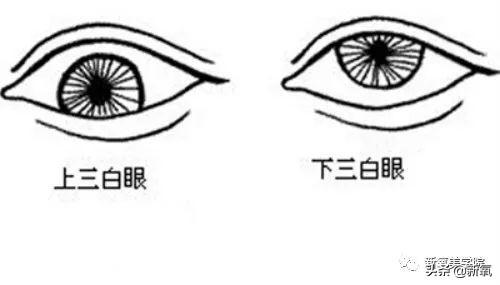 驼峰鼻面相图解_驼峰鼻面相学_鼻驼峰面相